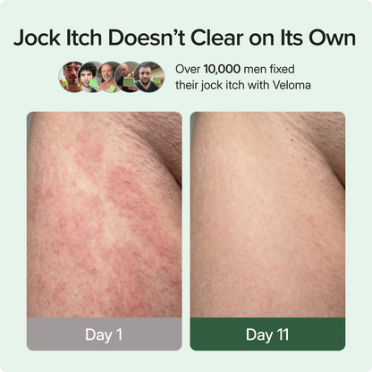 Antifungal Soap